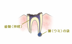 C4：歯根レベル